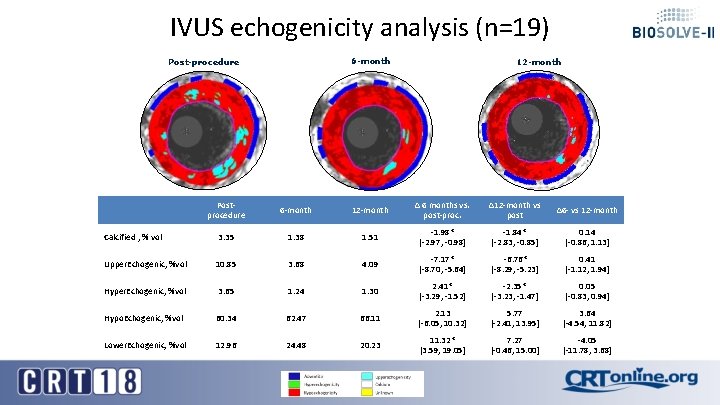 IVUS echogenicity analysis (n=19) 6 -month Post-procedure 12 -month Postprocedure 6 -month 12 -month