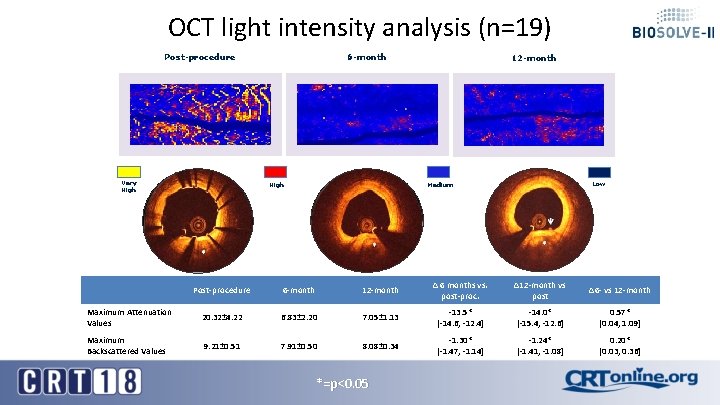 OCT light intensity analysis (n=19) Post-procedure Very High 6 -month High 12 -month Low