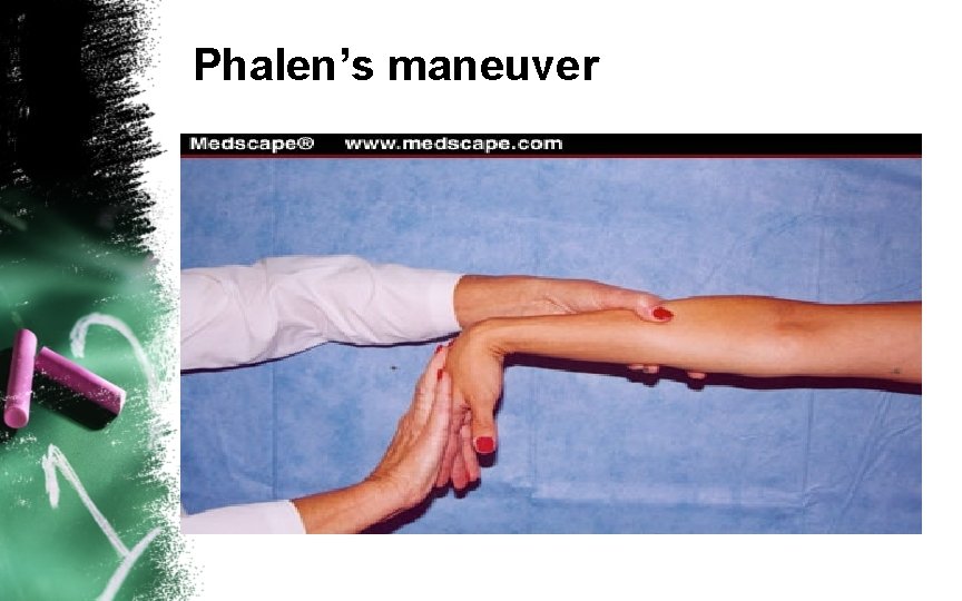 Phalen’s maneuver 