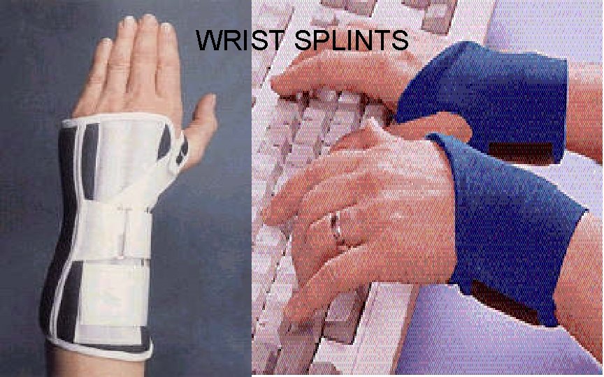 WRIST SPLINTS 