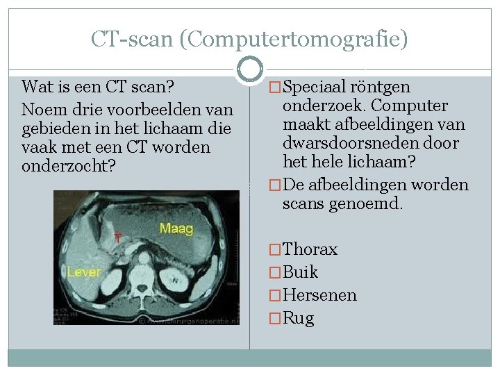 CT-scan (Computertomografie) Wat is een CT scan? Noem drie voorbeelden van gebieden in het