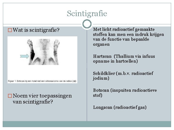 Scintigrafie � Wat is scintigrafie? Met licht radioactief gemaakte stoffen kan men een indruk