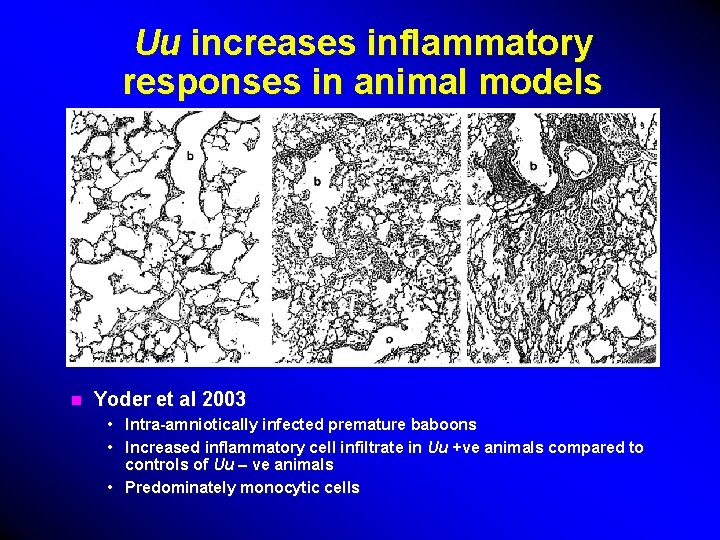 Uu increases inflammatory responses in animal models n Yoder et al 2003 • Intra-amniotically