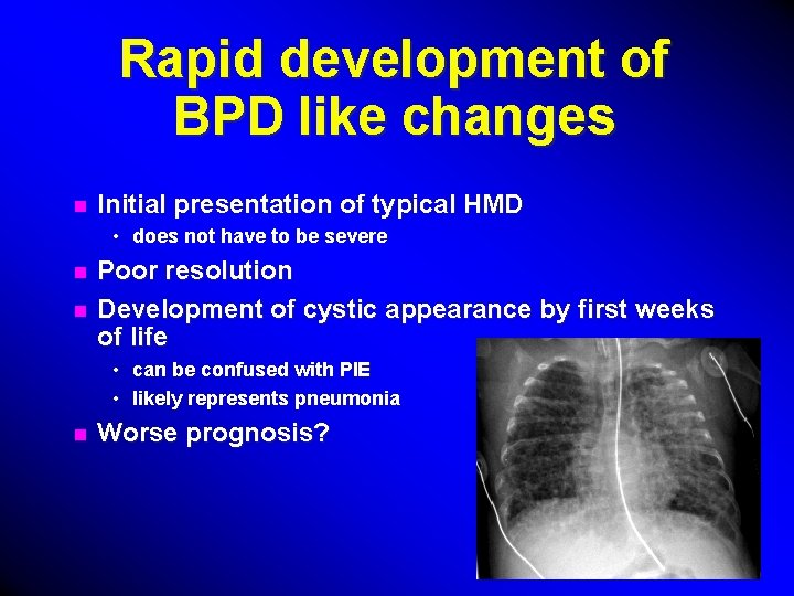 Rapid development of BPD like changes n Initial presentation of typical HMD • does