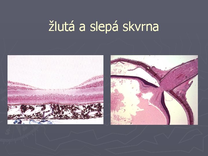 žlutá a slepá skvrna 