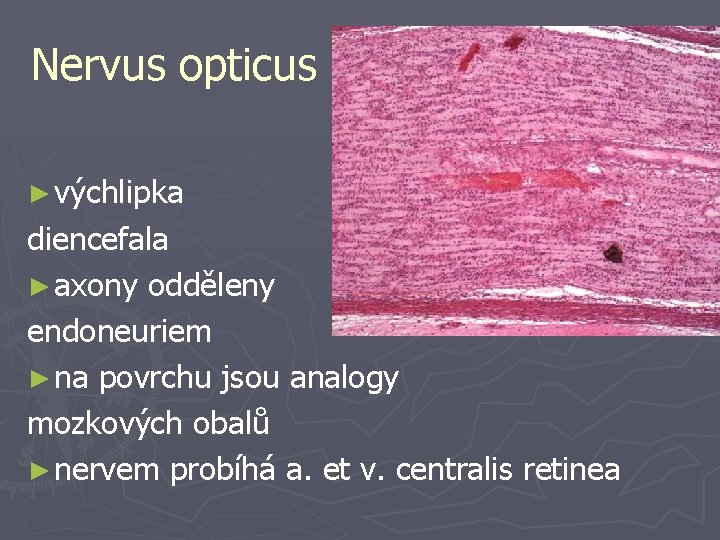 Nervus opticus ► výchlipka diencefala ► axony odděleny endoneuriem ► na povrchu jsou analogy