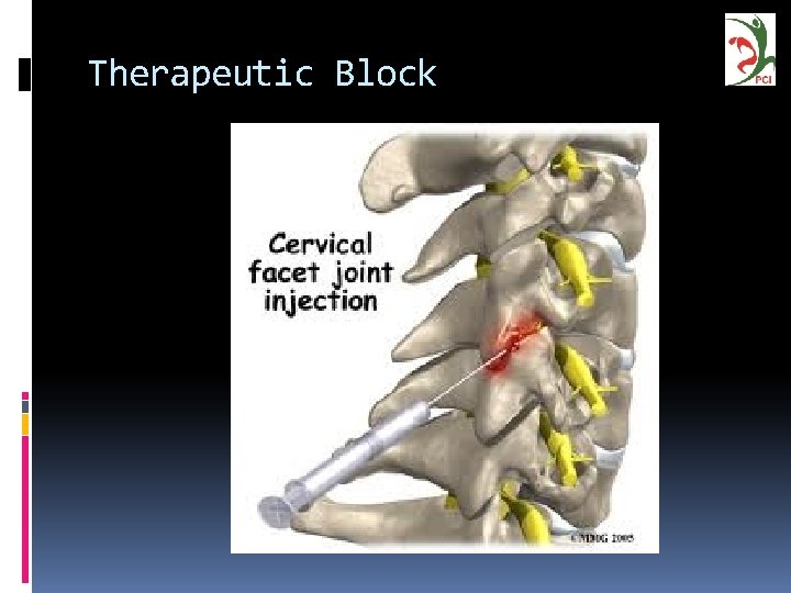 Therapeutic Block 