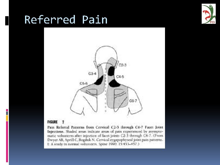 Referred Pain 