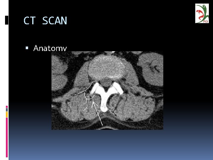 CT SCAN Anatomy 