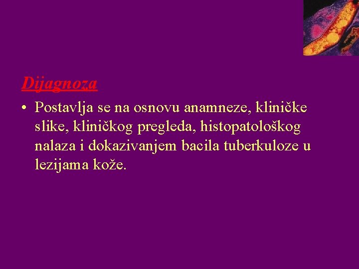 Dijagnoza • Postavlja se na osnovu anamneze, kliničke slike, kliničkog pregleda, histopatološkog nalaza i