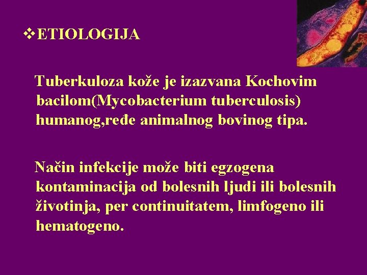 v. ETIOLOGIJA Tuberkuloza kože je izazvana Kochovim bacilom(Mycobacterium tuberculosis) humanog, ređe animalnog bovinog tipa.