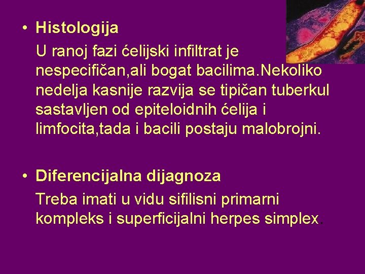  • Histologija U ranoj fazi ćelijski infiltrat je nespecifičan, ali bogat bacilima. Nekoliko