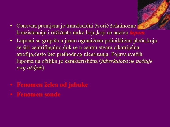  • Osnovna promjena je translucidni čvorić želatinozne konzistencije i ružičasto mrke boje, koji
