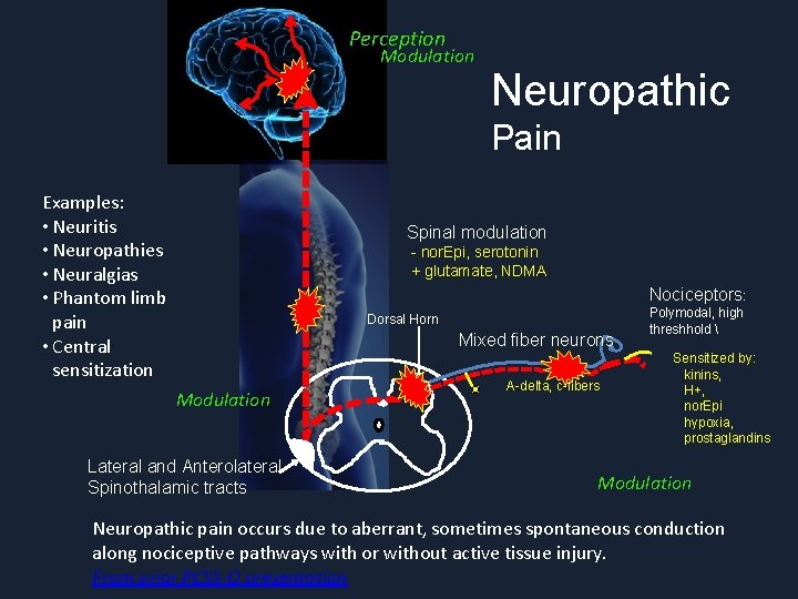 Perception Modulation Neuropathic Pain Examples: • Neuritis • Neuropathies • Neuralgias • Phantom limb