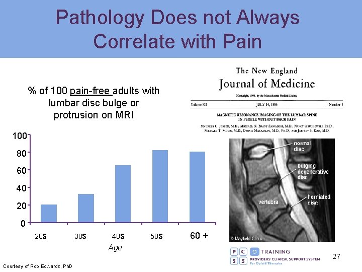 Pathology Does not Always Correlate with Pain % of 100 pain-free adults with lumbar