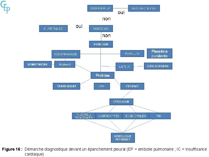 Figure 16 : Démarche diagnostique devant un épanchement pleural (EP = embolie pulmonaire ;