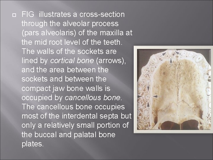  FIG illustrates a cross-section through the alveolar process (pars alveolaris) of the maxilla