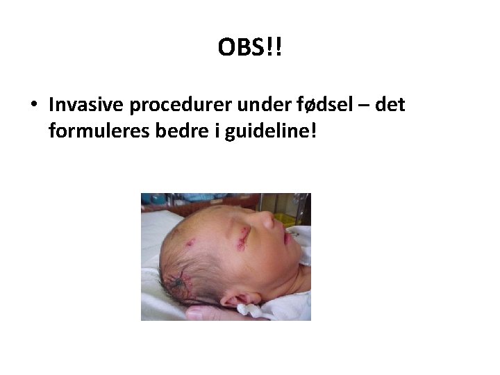 OBS!! • Invasive procedurer under fødsel – det formuleres bedre i guideline! 