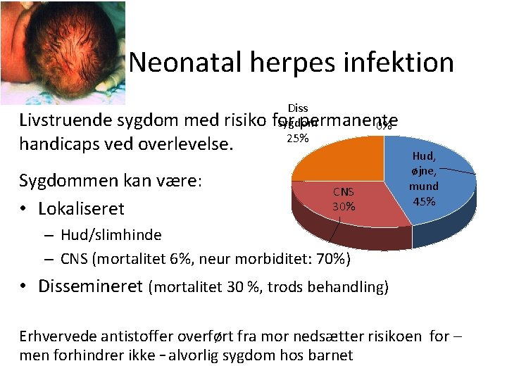 Neonatal herpes infektion Diss Livstruende sygdom med risiko for permanente sygdom 0% 25% handicaps