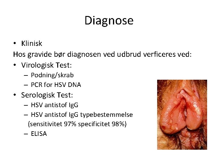 Diagnose • Klinisk Hos gravide bør diagnosen ved udbrud verficeres ved: • Virologisk Test: