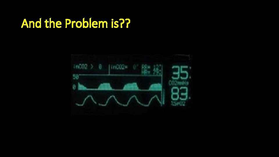 And the Problem is? ? 