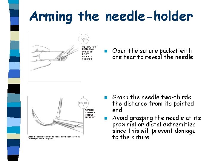 Arming the needle-holder n Open the suture packet with one tear to reveal the Arming the needle-holder n Open the suture packet with one tear to reveal the