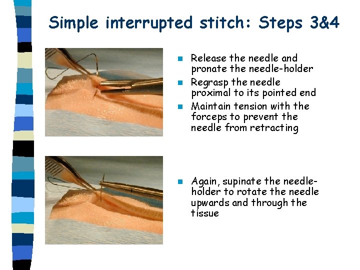 Simple interrupted stitch: Steps 3&4 Release the needle and pronate the needle-holder n Regrasp Simple interrupted stitch: Steps 3&4 Release the needle and pronate the needle-holder n Regrasp