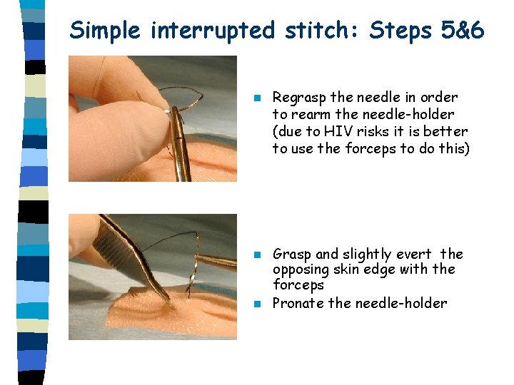 Simple interrupted stitch: Steps 5&6 n Regrasp the needle in order to rearm the Simple interrupted stitch: Steps 5&6 n Regrasp the needle in order to rearm the