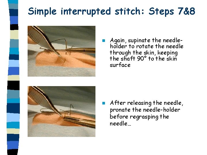 Simple interrupted stitch: Steps 7&8 n Again, supinate the needleholder to rotate the needle Simple interrupted stitch: Steps 7&8 n Again, supinate the needleholder to rotate the needle
