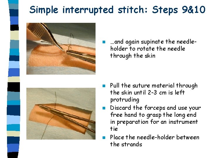 Simple interrupted stitch: Steps 9&10 n …and again supinate the needleholder to rotate the Simple interrupted stitch: Steps 9&10 n …and again supinate the needleholder to rotate the