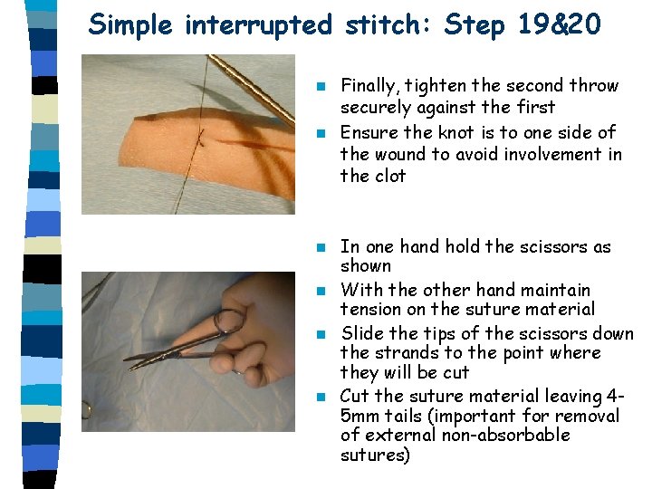 Simple interrupted stitch: Step 19&20 Finally, tighten the second throw securely against the first Simple interrupted stitch: Step 19&20 Finally, tighten the second throw securely against the first