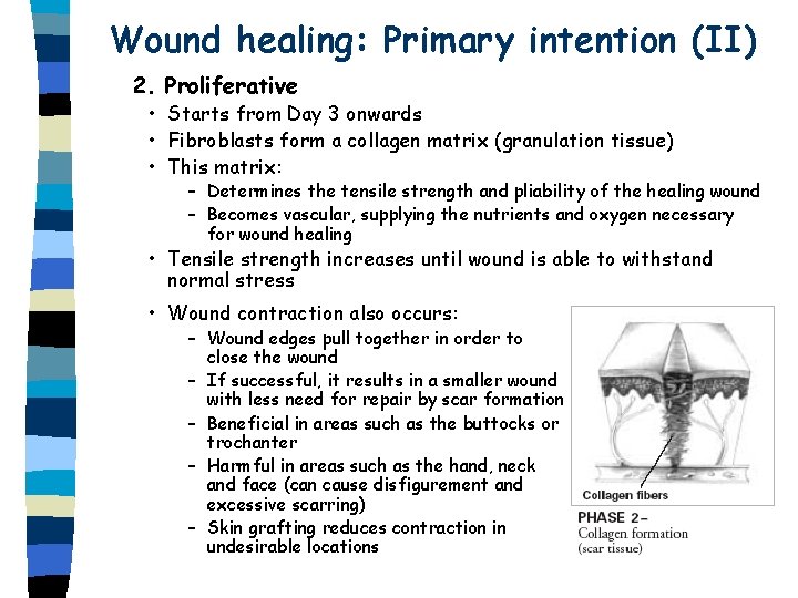 Wound healing: Primary intention (II) 2. Proliferative • Starts from Day 3 onwards • Wound healing: Primary intention (II) 2. Proliferative • Starts from Day 3 onwards •