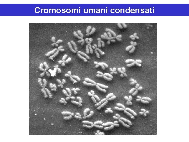 Cromosomi umani condensati 