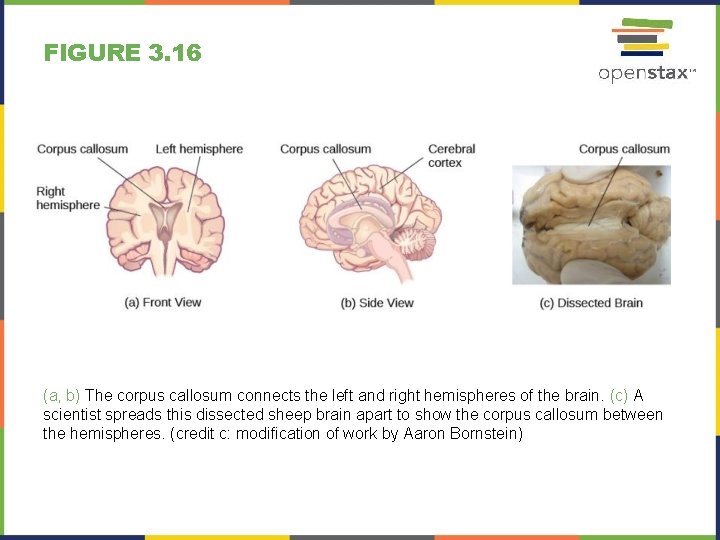 FIGURE 3. 16 (a, b) The corpus callosum connects the left and right hemispheres