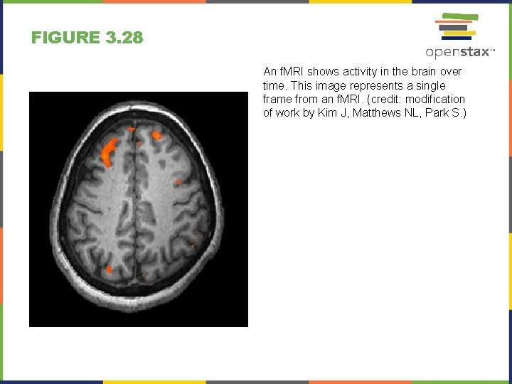 FIGURE 3. 28 An f. MRI shows activity in the brain over time. This