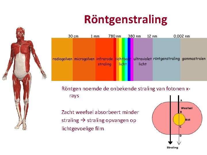 Röntgenstraling Röntgen noemde de onbekende straling van fotonen xrays Zacht weefsel absorbeert minder straling