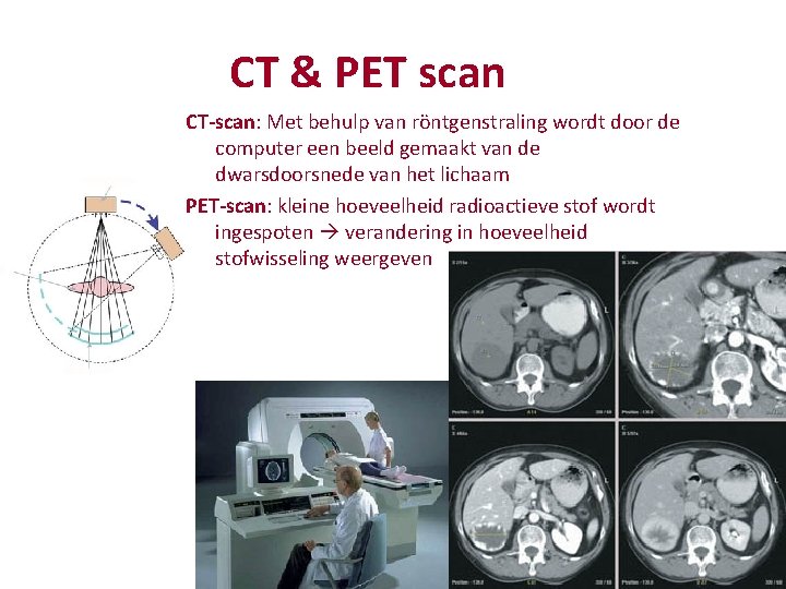 CT & PET scan CT-scan: Met behulp van röntgenstraling wordt door de computer een