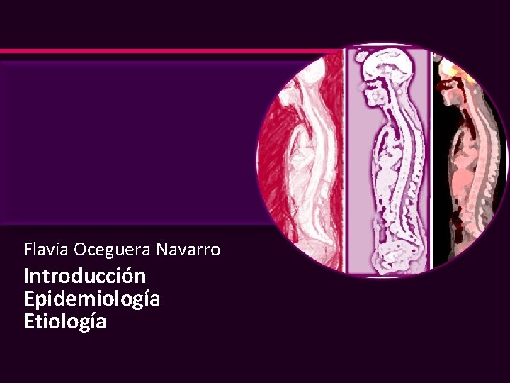 Flavia Oceguera Navarro Introducción Epidemiología Etiología 
