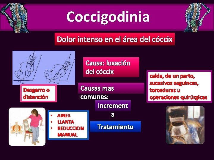 Coccigodinia Dolor intenso en el área del cóccix Causa: luxación del cóccix Desgarro o