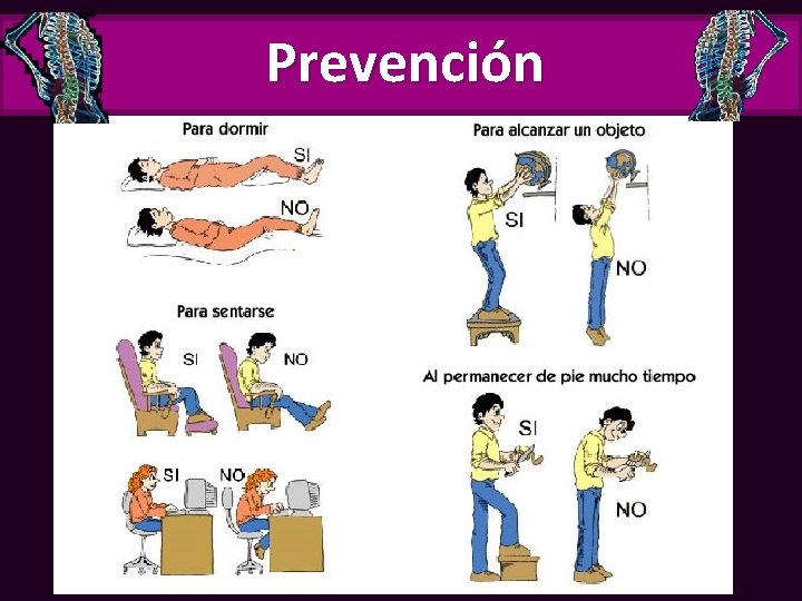 Prevención 