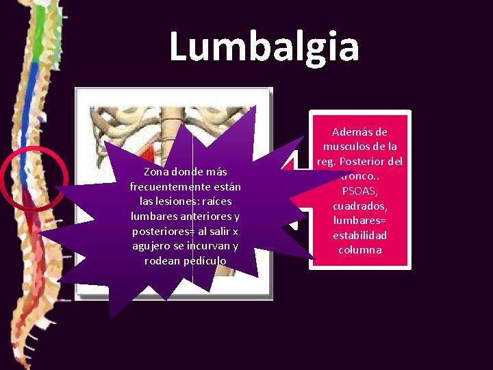 Lumbalgia Zona donde más frecuentemente están las lesiones: raíces lumbares anteriores y posteriores= al