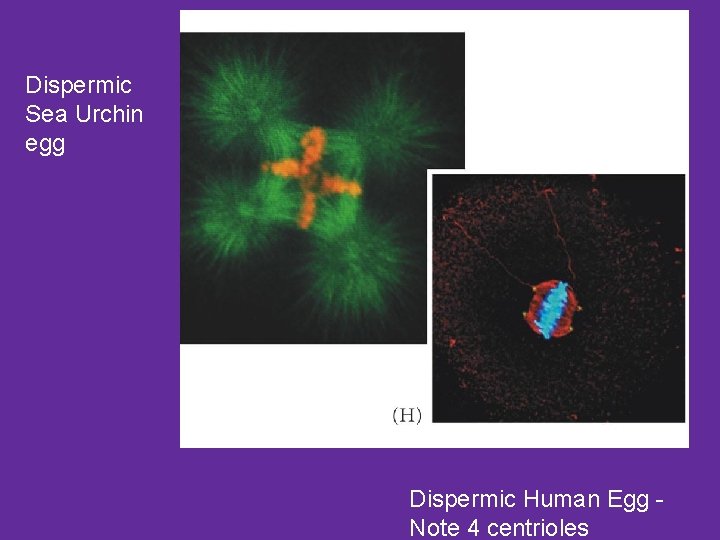 Dispermic Sea Urchin egg Dispermic Human Egg Note 4 centrioles 