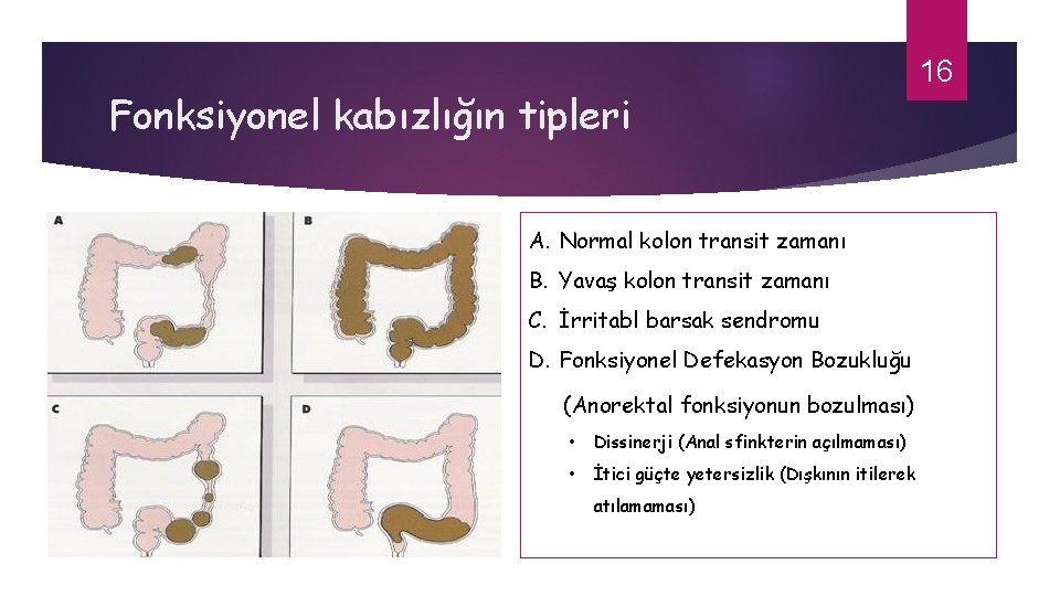 Fonksiyonel kabızlığın tipleri 16 A. Normal kolon transit zamanı B. Yavaş kolon transit zamanı