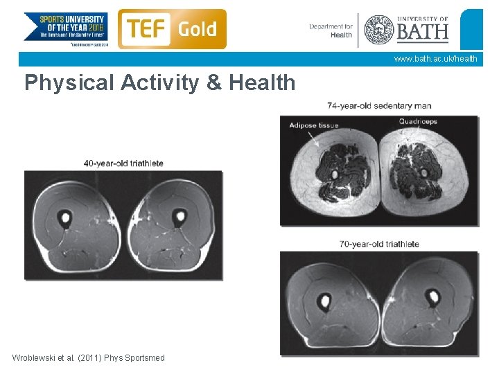 www. bath. ac. uk/health Physical Activity & Health Wroblewski et al. (2011) Phys Sportsmed