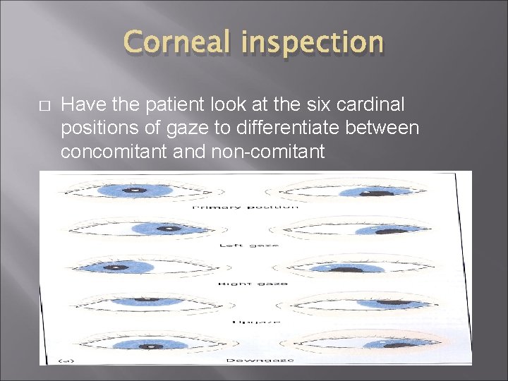 Corneal inspection � Have the patient look at the six cardinal positions of gaze