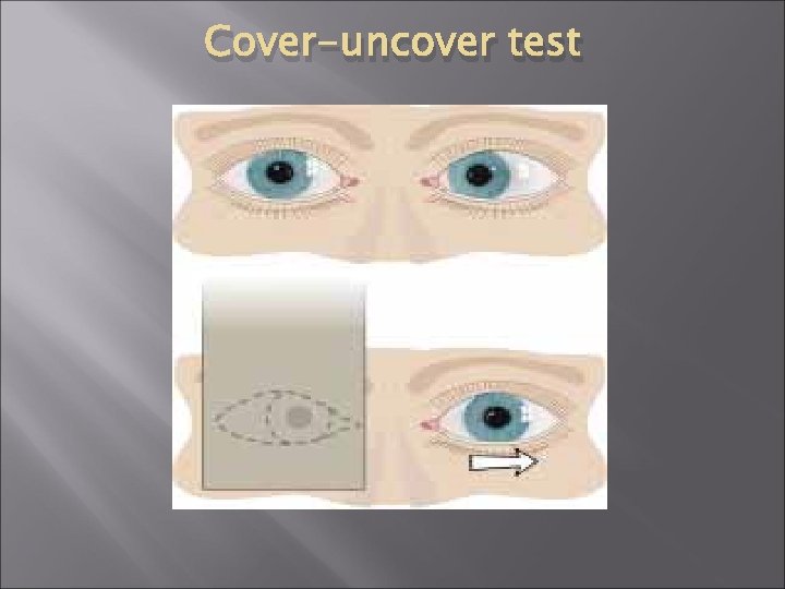 Cover-uncover test 