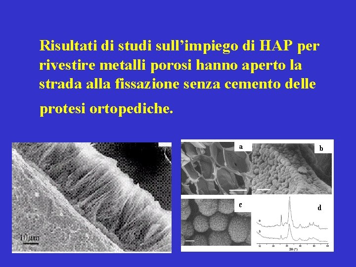 Risultati di studi sull’impiego di HAP per rivestire metalli porosi hanno aperto la strada