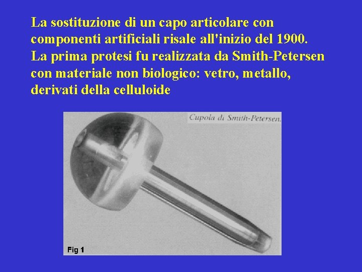 La sostituzione di un capo articolare con componenti artificiali risale all'inizio del 1900. La