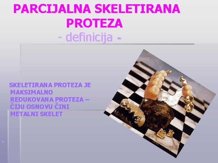 PARCIJALNA SKELETIRANA PROTEZA - definicija - SKELETIRANA PROTEZA JE MAKSIMALNO REDUKOVANA PROTEZA – ČIJU