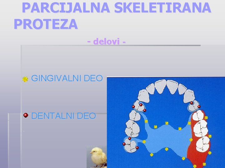 PARCIJALNA SKELETIRANA PROTEZA - delovi - § GINGIVALNI DEO § DENTALNI DEO. 